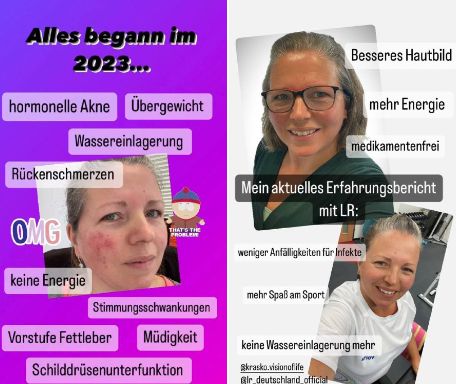 Erfahrungsbericht: Darm-Leber-Zellstoffwechsel-Kur gegen Akne, Müdigkeit & Wassereinlagerungen Erfahrungsbericht zur Darm-Leber-Zellstoffwechsel-Kur bei Akne, Müdigkeit und Wassereinlagerungen